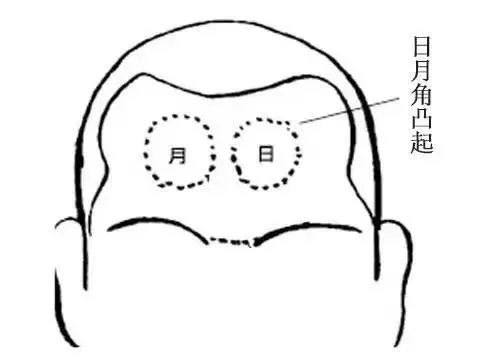 日月角凸起代表什么？是贵人相吗？