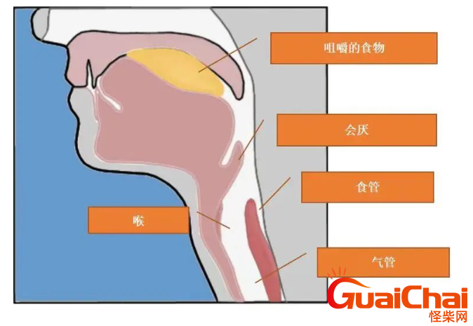 急性会厌炎是重大疾病吗？是什么原因引起的？