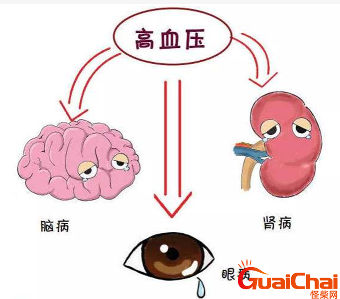 血压高的原因有哪些？血压高是怎么引起的？