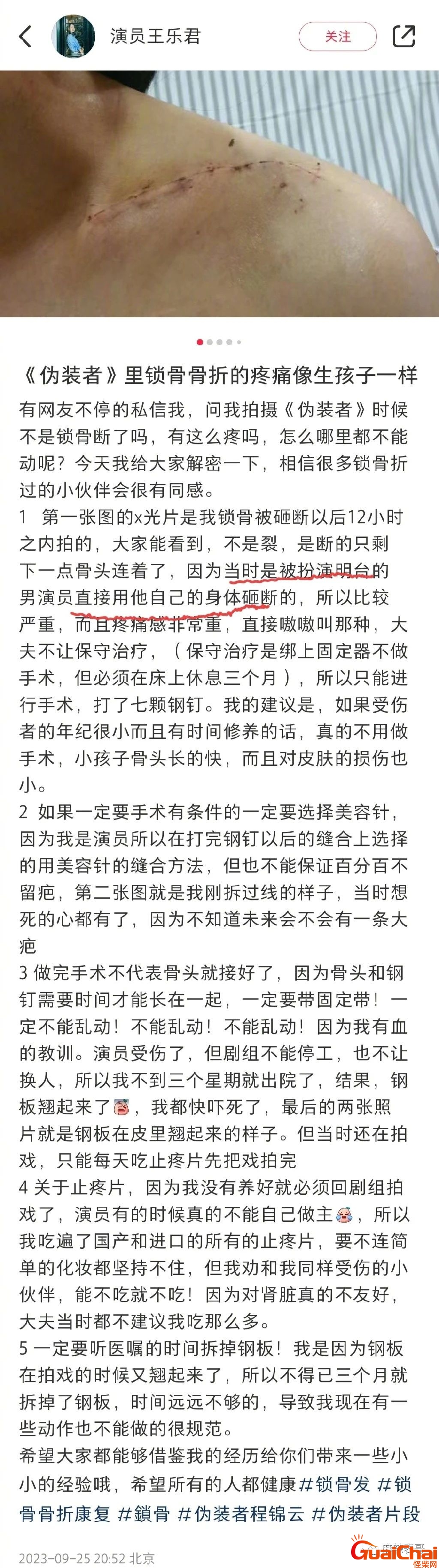 程锦云的扮演者叫什么？王乐君控诉胡歌拍《伪装者》故意用身体砸断她锁骨！